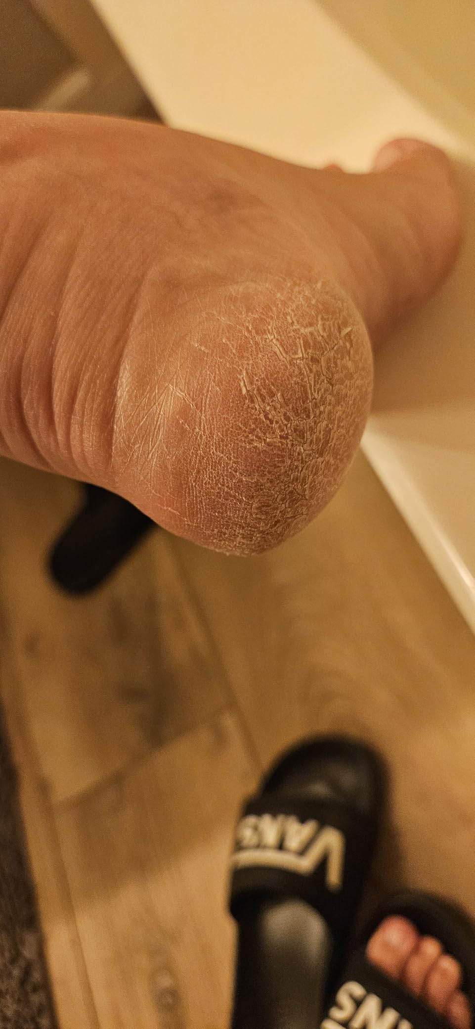 Colossal Foot rasp Foot File and Callus Remover. Best Foot Care Pedicure Metal Surface Tool to Remove Hard Skin. Can be Used on Both Wet and Dry feet, High Grade Stainless Steel File customer photo 1