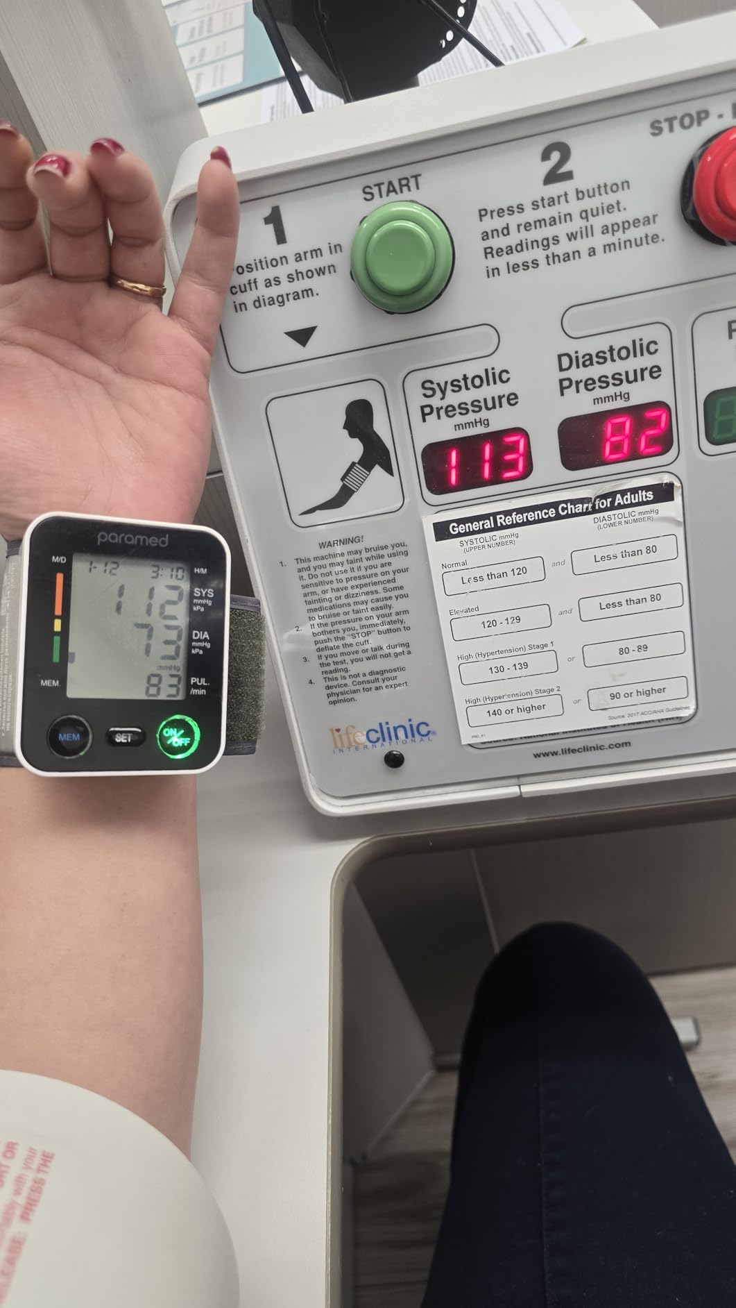 PARAMED Automatic Wrist Blood Pressure Monitor: Blood-Pressure Kit of Bp Cuff + 2AAA and Carrying case - Irregular Heartbeat Detector & 90 Readings Memory Function & Large Display customer photo 2