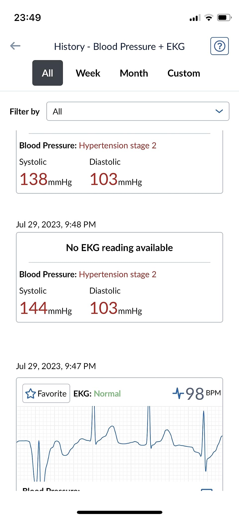 OMRON Complete 2-in-1 Blood Pressure Monitor + EKG for Home Use & Upper Arm Blood Pressure Cuff - #1 Doctor & Pharmacist Recommended Brand - Clinically Validated - Connect App customer photo 1