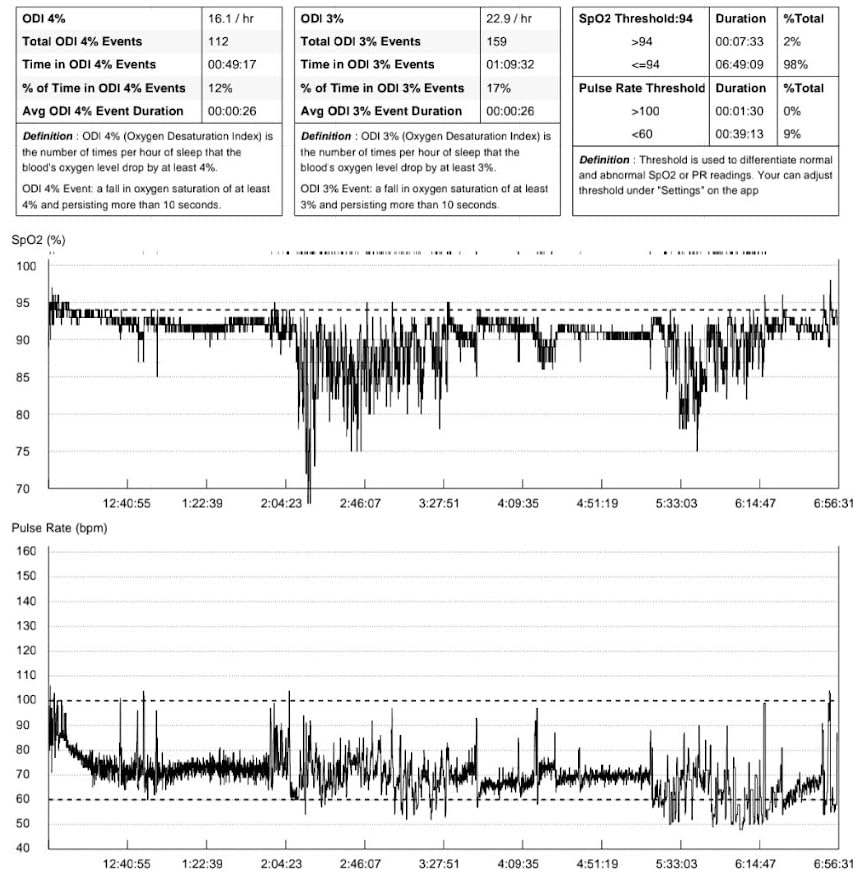 EMAY Sleep Oxygen Monitor with Built-in Recording Capability | Track Continuous Blood Oxygen Levels & Pulse Rate Overnight | Provides Sleep Report & Raw Data customer photo 2