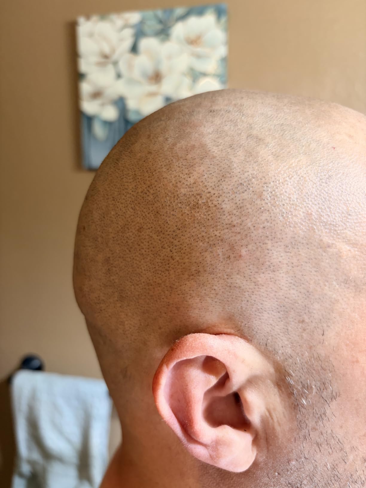 Skull Shaver Pitbull Silver PRO SX5 - Head & Face Shaver for Bald Men | Cordless Wet/Dry Rotary Razor customer photo 1