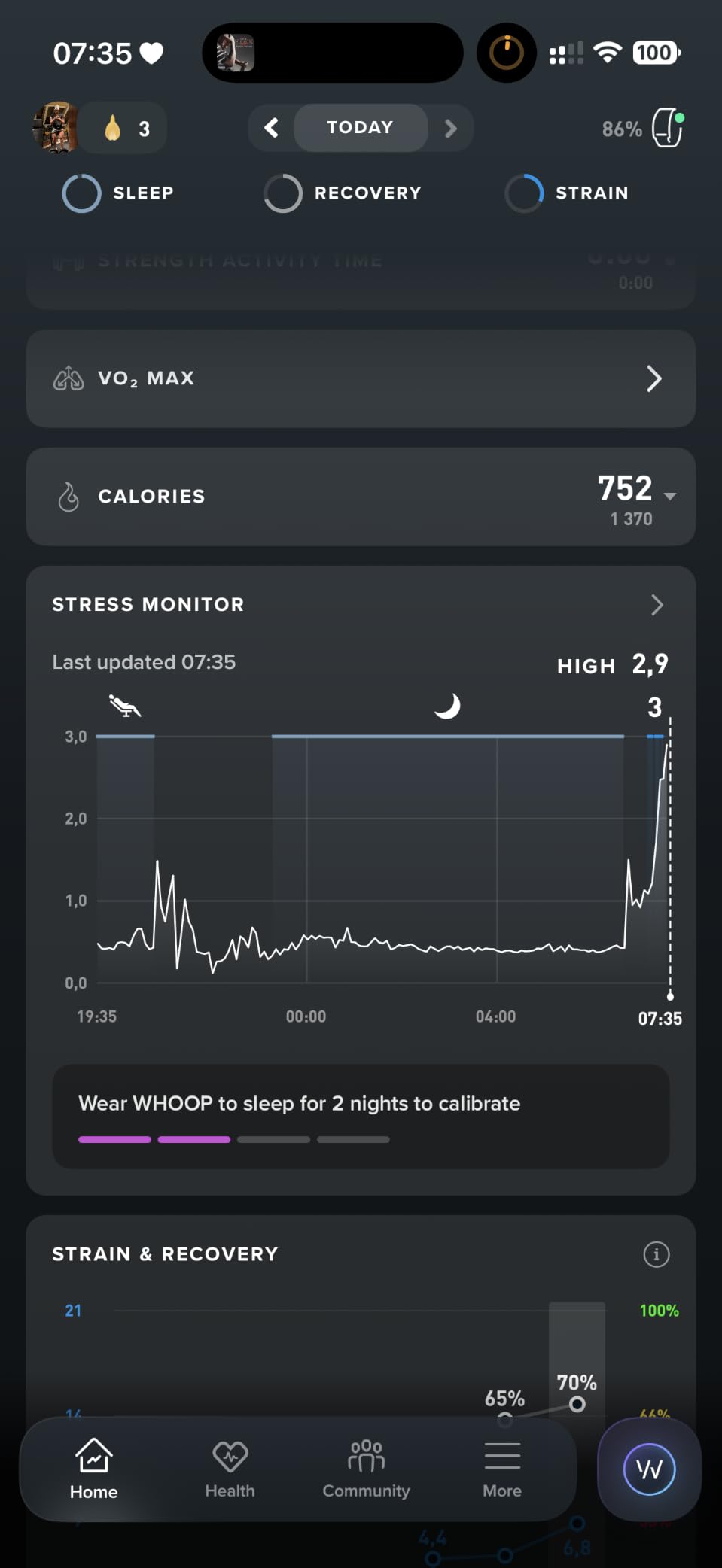 WHOOP 5.0/MG Activity Tracker - 12 Month Membership - Health and Fitness Wearable customer photo 2