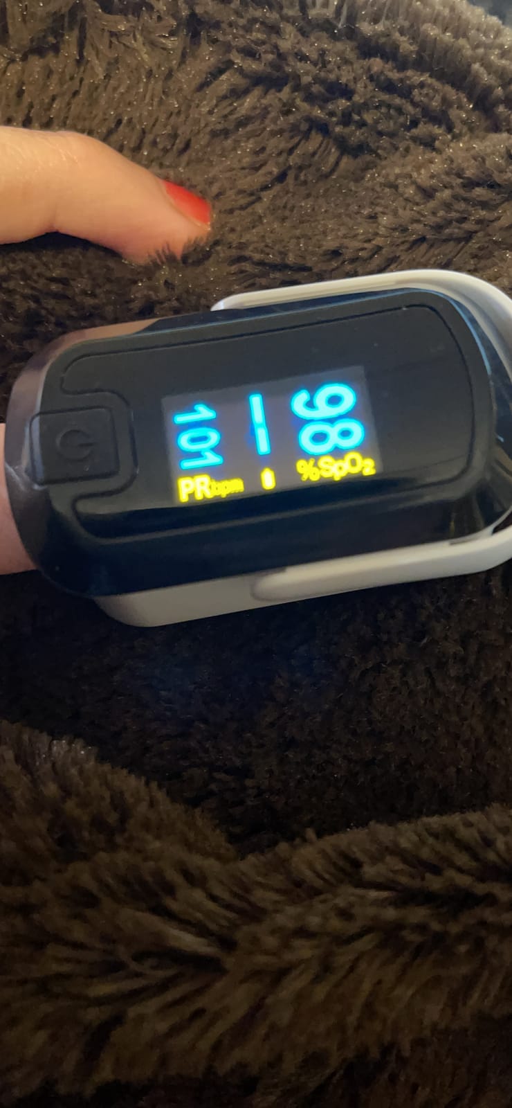 mibest OLED Finger Pulse Oximeter, O2 Meter, Dual Color White/Black customer photo 2