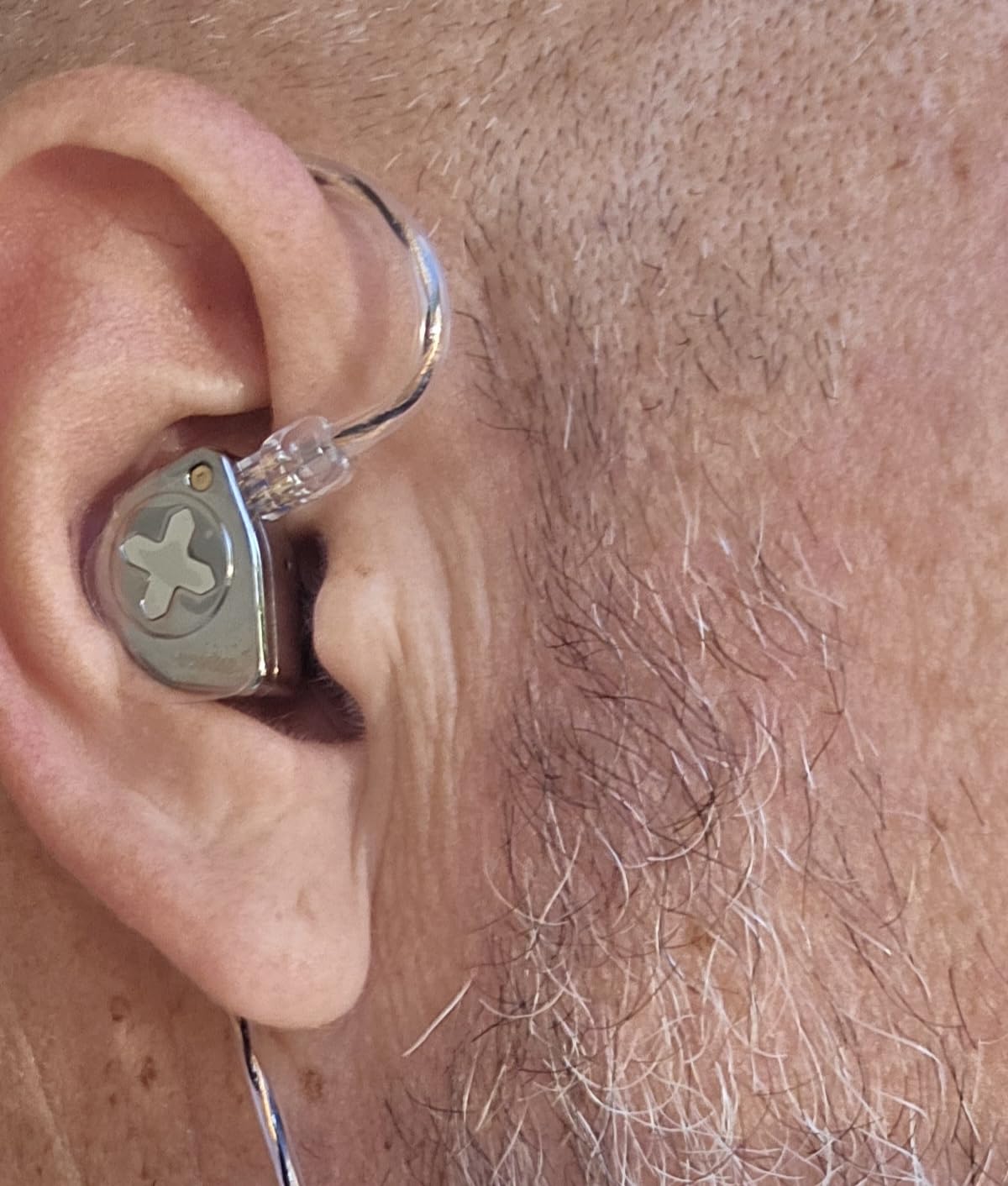 Linsoul SIMGOT EW300 1DD+1Planar+1PZT Hybrid Driver IEMs, Standard Edition customer photo 1